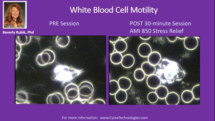 White Blood Cell Motility