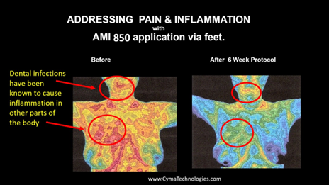Addressing pain and inflation thermal image