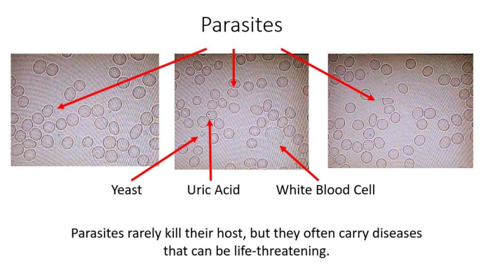 Slides of Parasites, Yeast, Uric Acid, and White Blood Cells.